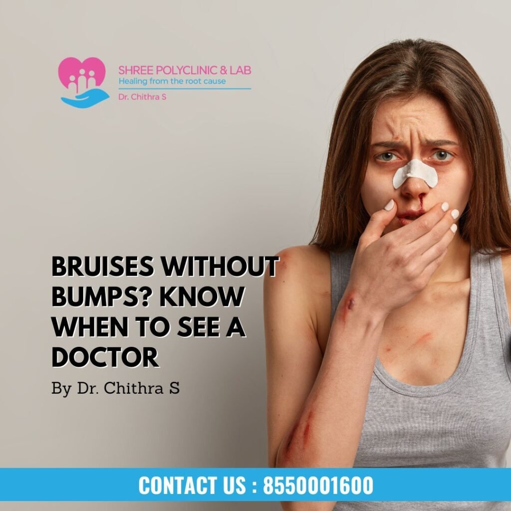 Bruises Without Bumps? Know When to See a Doctor