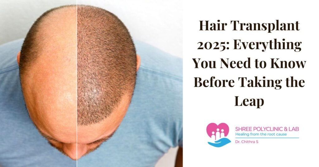 Hair Transplant 2025: Everything You Need to Know Before Taking the Leap